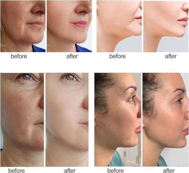 Picture of Galvanic Spa - Facial Toning Device - Micro-Current face Tone and Contours Device