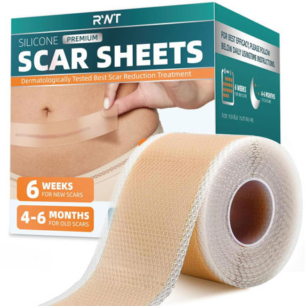 Picture of Silicone Scar Sheets Surgical Scars