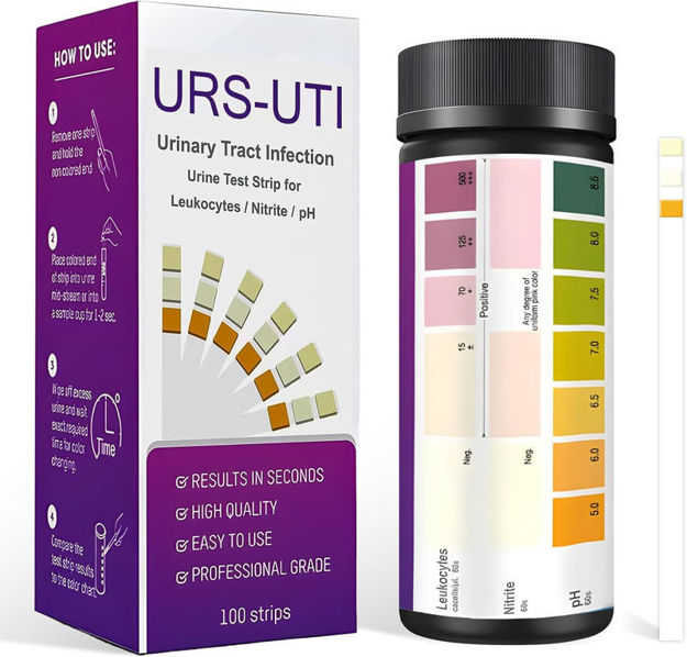 Picture of Infection Accurate Leukocytes Readings Urinalysis
